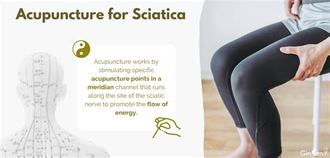 Is Acupuncture Good For Sciatica Nerve