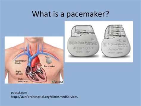is an icd the same as a pacemaker