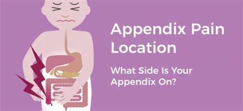 is appendix pain left or right side