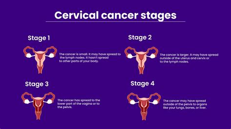 is cervical cancer hereditary