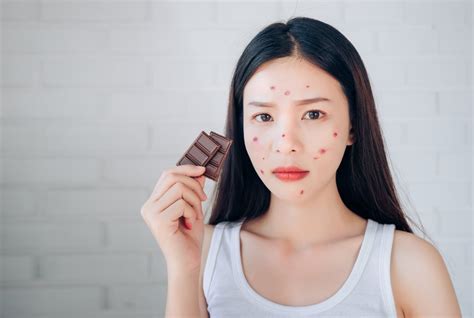Is Cocoa A Common Allergy