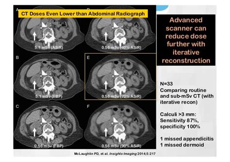 Is Ct Stone Protocol With Contrast