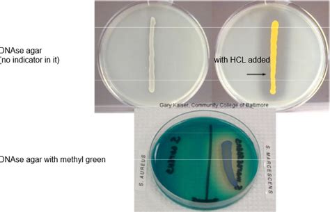 is dnase agar selective or differential