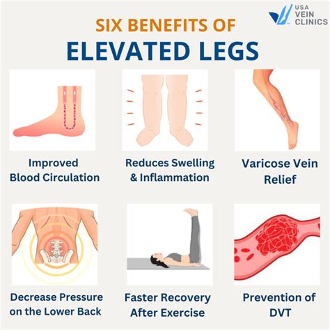 Is Elevating Legs Good