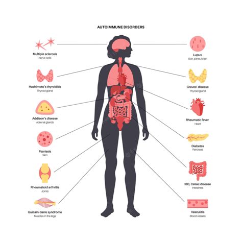 is endometriosis an immune disorder