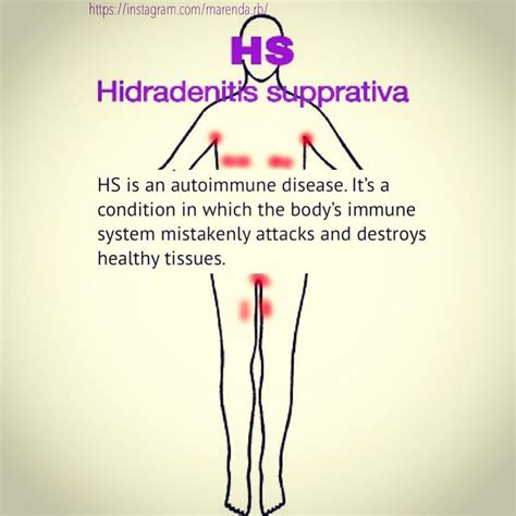is hidradenitis suppurativa an autoimmune disease