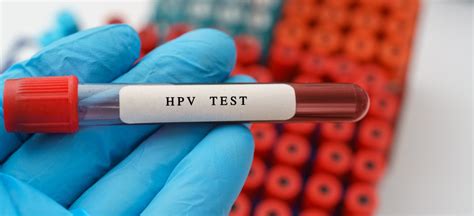 is hpv test a blood test