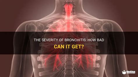 is it bad to exercise with bronchitis