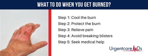 Is It Better To Keep A Burn Covered