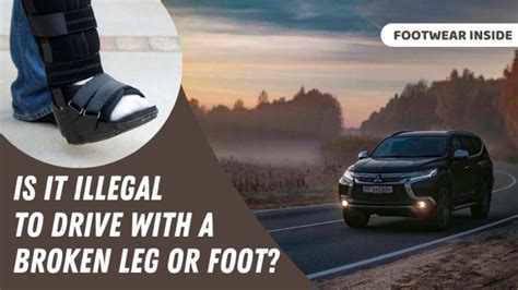 Is It Illegal To Drive With A Walking Boot