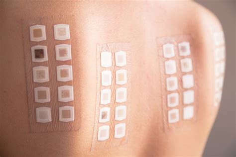 Is It Illegal To Not Do A Patch Test
