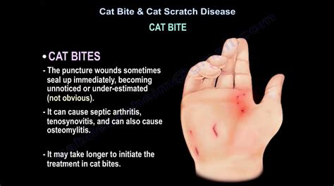 is it normal for kittens to bite and scratch