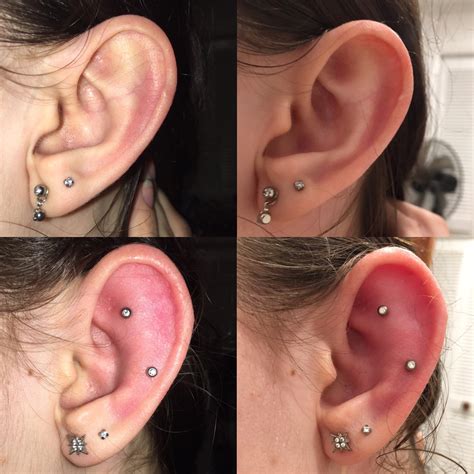 is it normal for my ear to be swollen after cartilage piercing