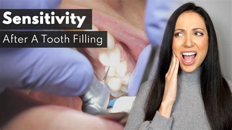 is it normal for teeth to be sensitive after cavity filling