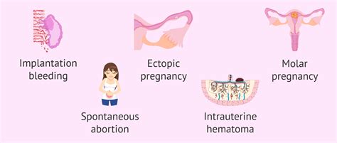 is it normal to spot in the first trimester