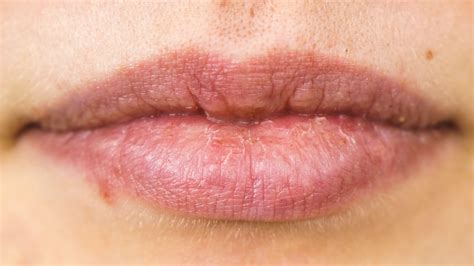is it possible to be allergic to certain toothpaste