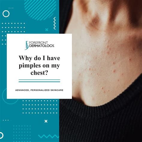 Is It Possible To Get Pimples On Your Chest