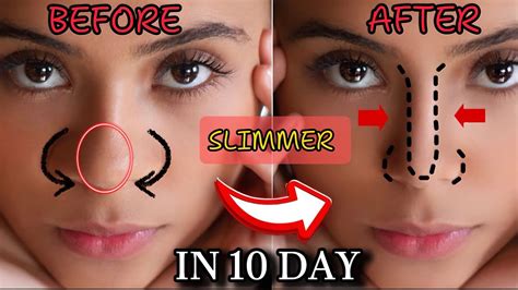 is it possible to get slim nose by exercise