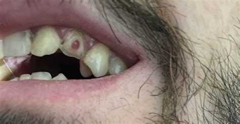 Is It Possible To Puke From Crying Too Much