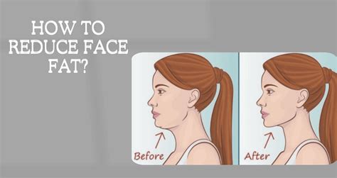 Is It Possible To Reduce Face Fat