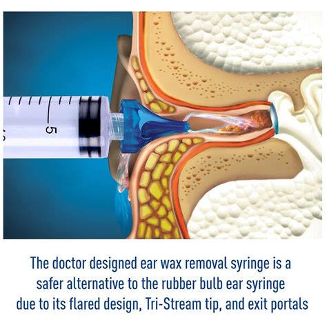Is It Safe To Use A Syringe To Remove Ear Wax