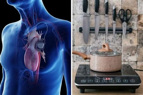 Is It Safe To Use An Induction Hob With A Pacemaker