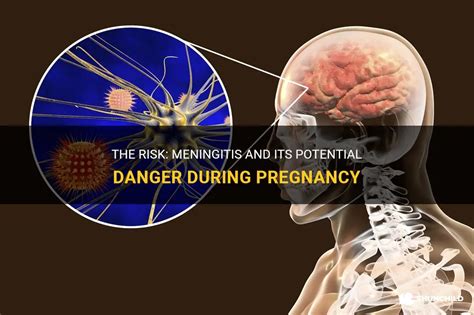 is meningitis dangerous during pregnancy
