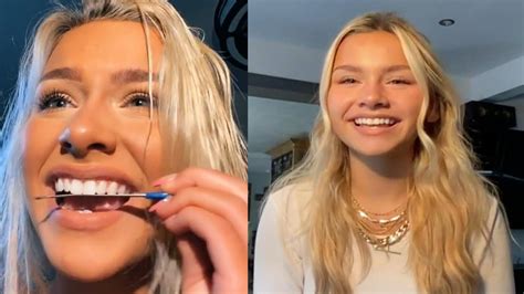 Is Nail Filing Your Teeth Bad