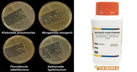 is nutrient agar differential