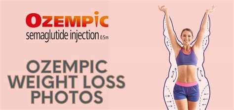 is ozempic safe for weight loss