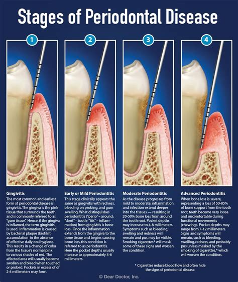 is periodontal disease reversible