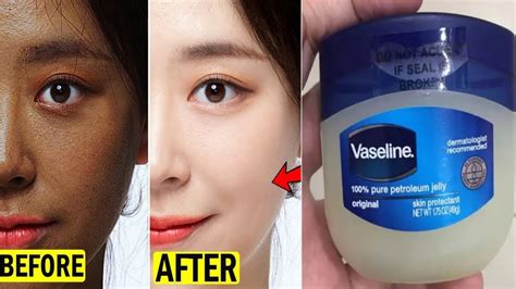 is petroleum jelly good for face