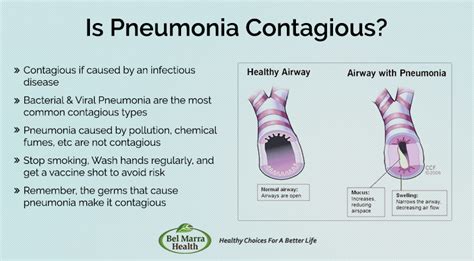 Is Pneumonia Catching: Understanding the Contagious Nature of Pneumonia