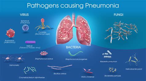 Is Pneumonia Contagious? Understanding the Risks and Transmission Methods