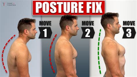 Is Poor Posture Permanent