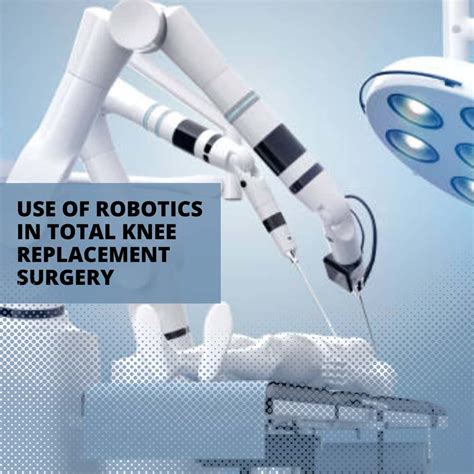 Is Robotic Total Knee Replacement Better