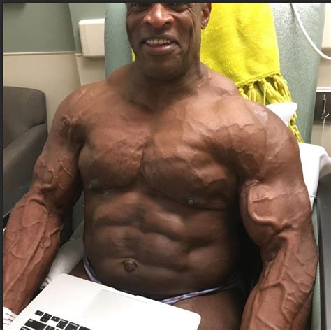 is ronnie coleman sick