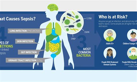 is sepsis infection contagious