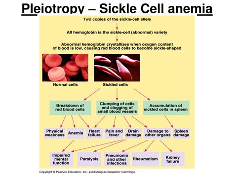 Is Sickle Cell Anemia An Example Of Pleiotropy
