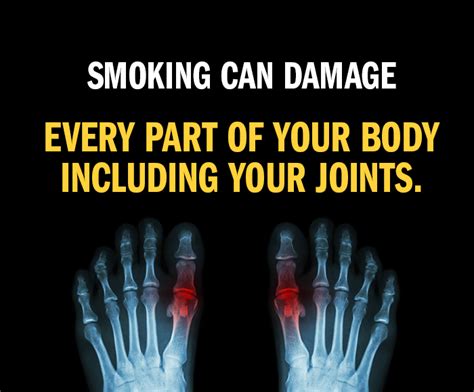 Is Smoking Related To Arthritis