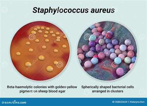 is staph aureus encapsulated