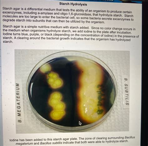 is starch agar selective or differential