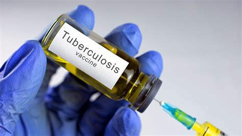 Is There a TB Immunization: Protecting Against Tuberculosis