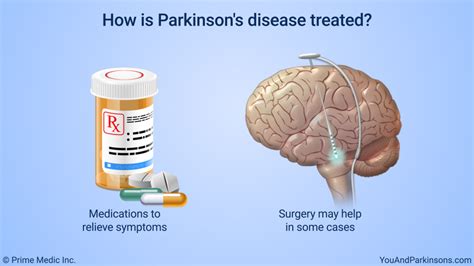 is there a treatment for parkinson disease
