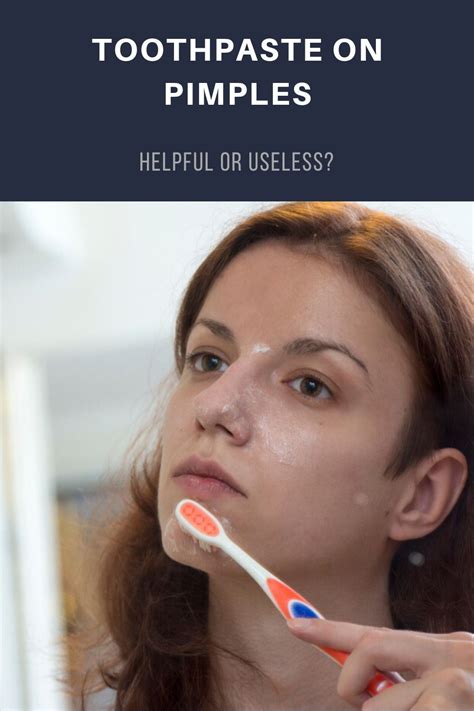 Is Toothpaste Good For Pimples Reddit
