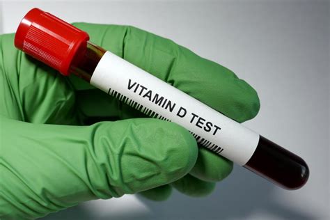 is vitamin d blood test fasting