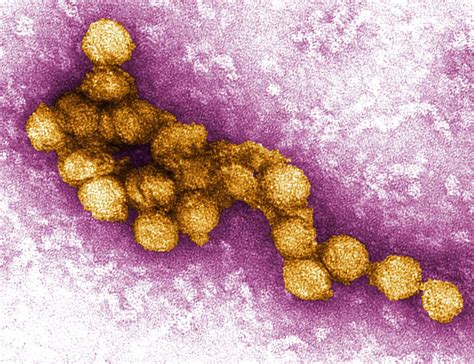 is west nile virus viral or bacterial