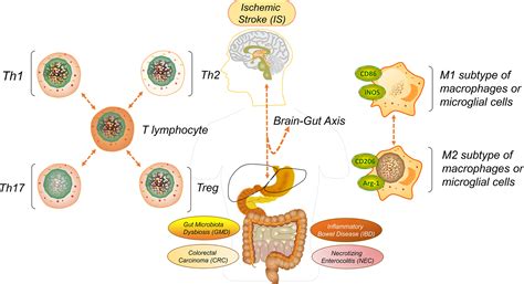 Ischemic Colitis Leukemia