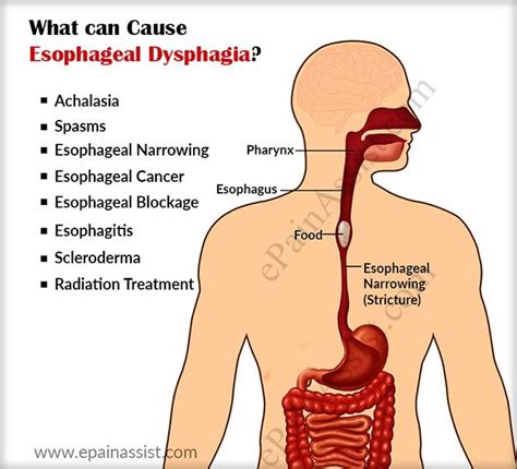 issues with the esophagus