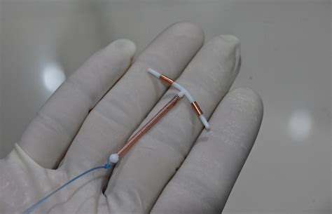 What You Need to Know About IUD in Arm: A Comprehensive Guide to Long-Term Contraception